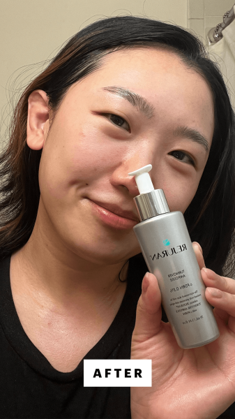 Sarah Han after applying Rejuran Turnover Ampoule